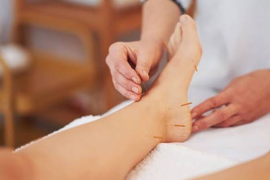 Acupuncture at Levi Acupuncture & Massage