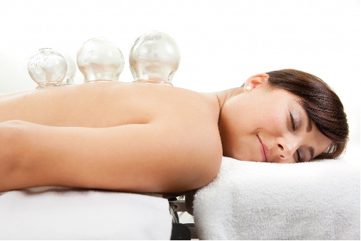 Cupping at Levi Acupuncture & Massage