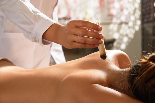 Moxibustion at Levi Acupuncture & Massage
